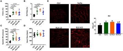 Relaxin Inhibits Ventricular Arrhythmia and Asystole in Rats With Pulmonary Arterial Hypertension